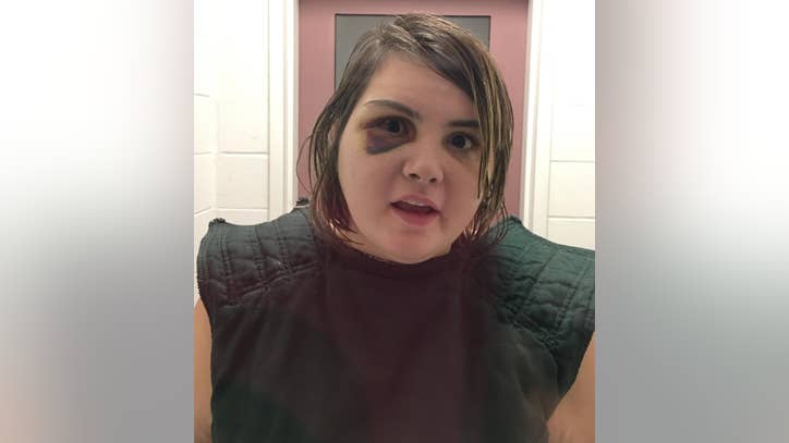 Federal GJ subpoenas records of Gwinnett deputy beating ...