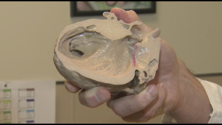 9ddbc7c3-3d printed heart_1496624315175-408200.PNG