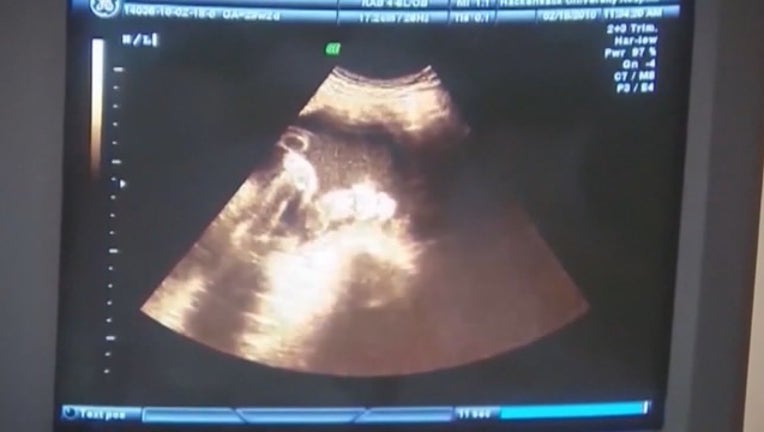 V ALABAMA ABORTION LAW 5P _00.00.21.26_1558044457281.png.jpg