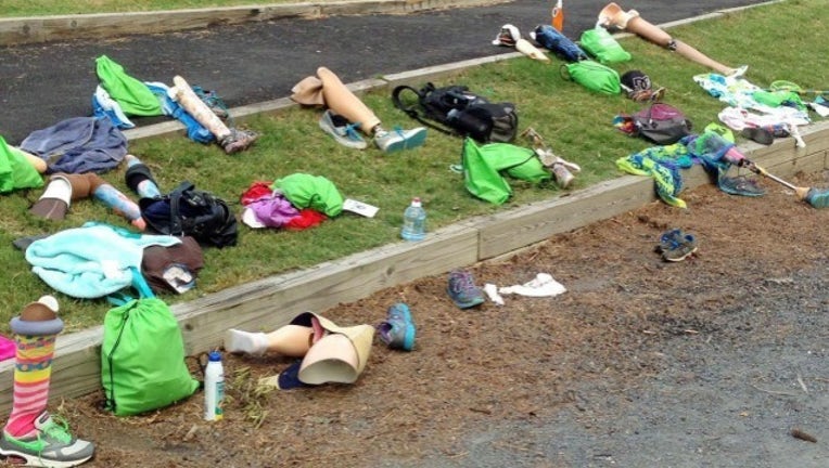 44f761e2-CHOA prosthetics_1496851051025.jpg