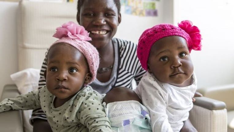 conjoined_twins_nationwide_mom_1441736862498.jpg