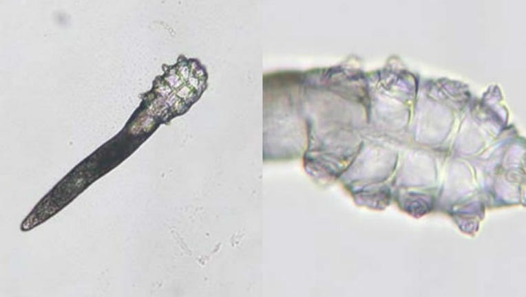 39e6c42b-demodex-mites_1558539290813-404023.jpg