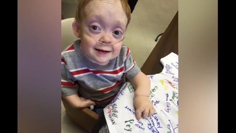 Teen With Rare Disorder Seeks Donations For Sick Kids In Lieu Of