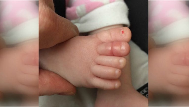 pic of baby toe_1454588529288.jpg