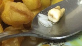 Woman finds tooth in her Chinese food, restaurant claims it's 'from the onion'