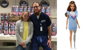 Teen born without limb donates hundreds of Barbies with prosthetic leg to children’s hospital