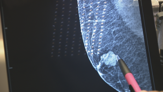 Man fights disease he thought he'd never face, breast cancer