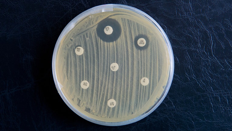 MRSA__Banner__Getty.jpg