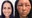 Woman's allergic reaction to hair dye causes severe swelling in face, head