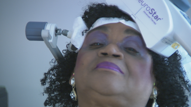 After 20 years of depression, Georgia woman finds a breakthrough: TMS