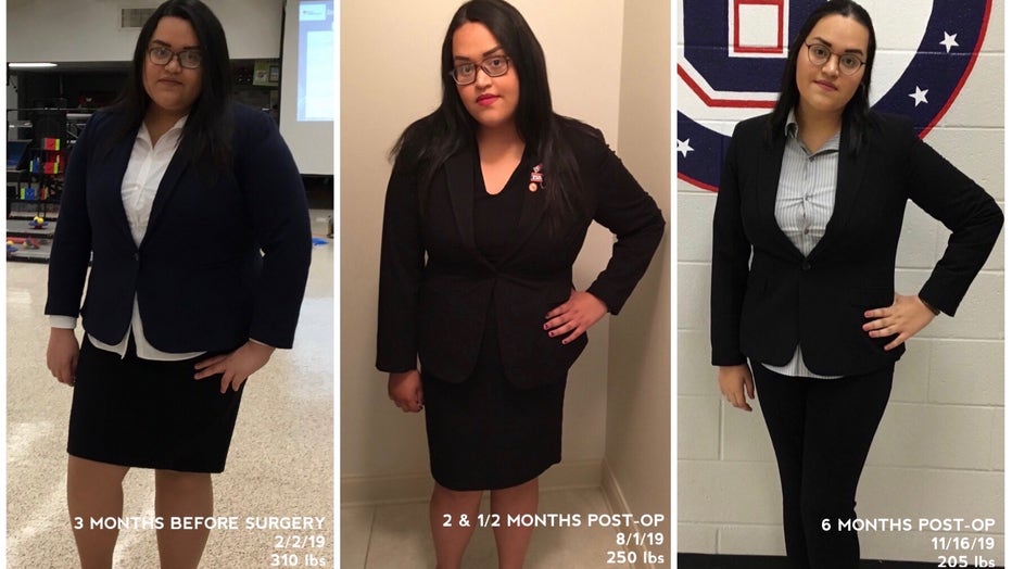 Series of photos track teen's weight loss