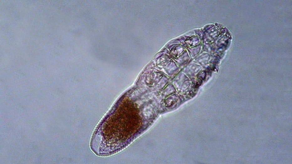 Demodex mite see through a microscope.