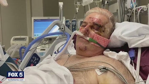 Georgia professor nearly killed in Baltimore hit and run