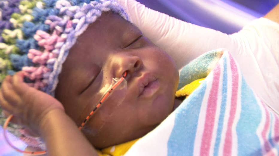 newborn baby in the NICU