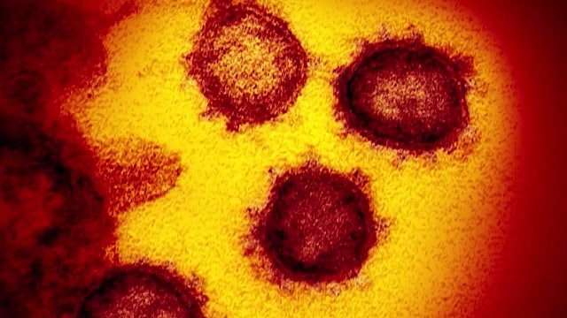 Number being monitored in Nassau County for coronavirus drops