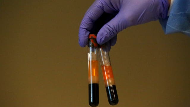 CDC beginning COVID-19 antibody survey Tuesday in Georgia counties