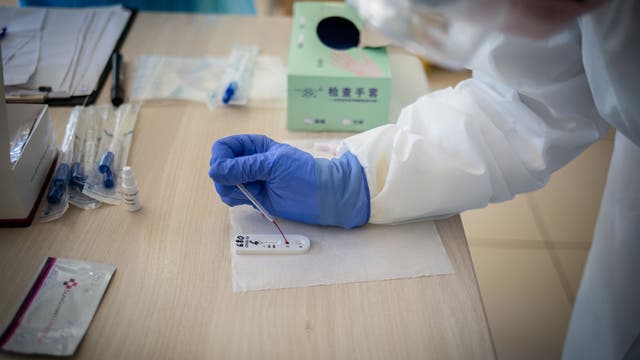 US to rein in flood of virus blood tests after lax oversight
