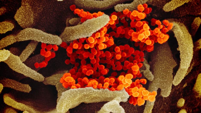 Study finds COVID-19 'virus-laden aerosol' in air inside Wuhan hospitals that treated patients