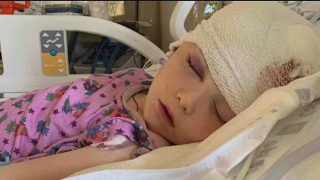 Boy, 7, recovering after allegedly random attack by 32-year-old man left him with a fractured skull