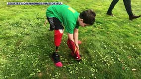 8-year-old amputee receives Iron Man bionic arm