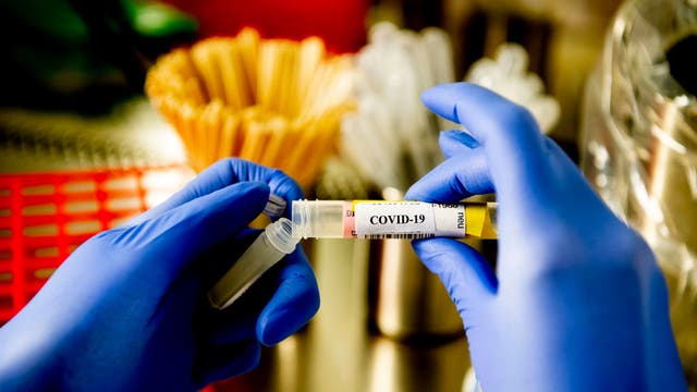 What are the different types of COVID-19 tests?