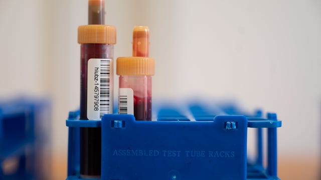 Study: Antibody drug may reduce COVID-19 hospitalizations