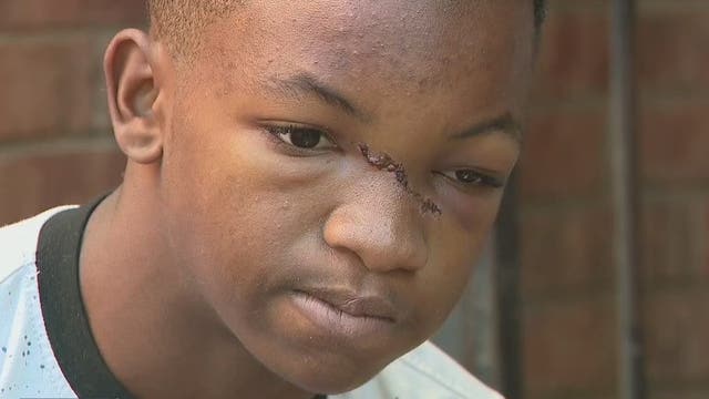 Boy selling water at Atlanta intersection hit by car