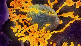 Man infected with coronavirus variant in upstate New York