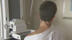 Mammograms down 15% during pandemic, health system reports