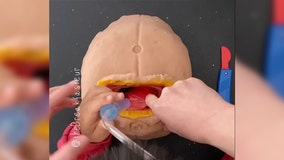 Doctor teaches 4-year-old son how to perform surgeries using play dough