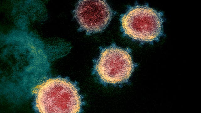 Unpredictability of COVID-19 severity may come down to antibody response, study shows