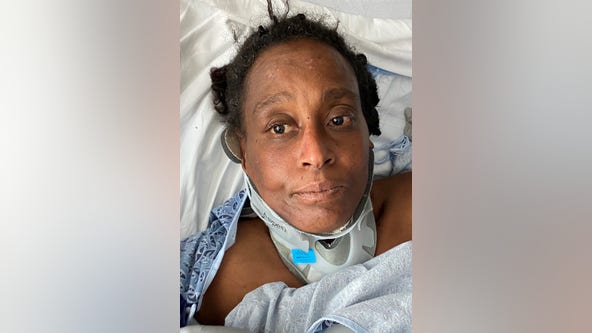 Atlanta hospital asking for help identifying woman hit by car