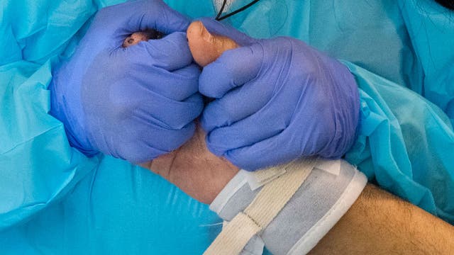 COVID-19 toll in US projected to drop this summer, but variants could set back progress