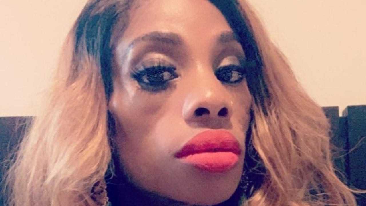 After Lupus changed her face, Atlanta woman turns to surgery for