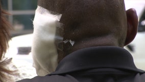 Atlanta police searching for man accused of biting off a piece of victim's ear