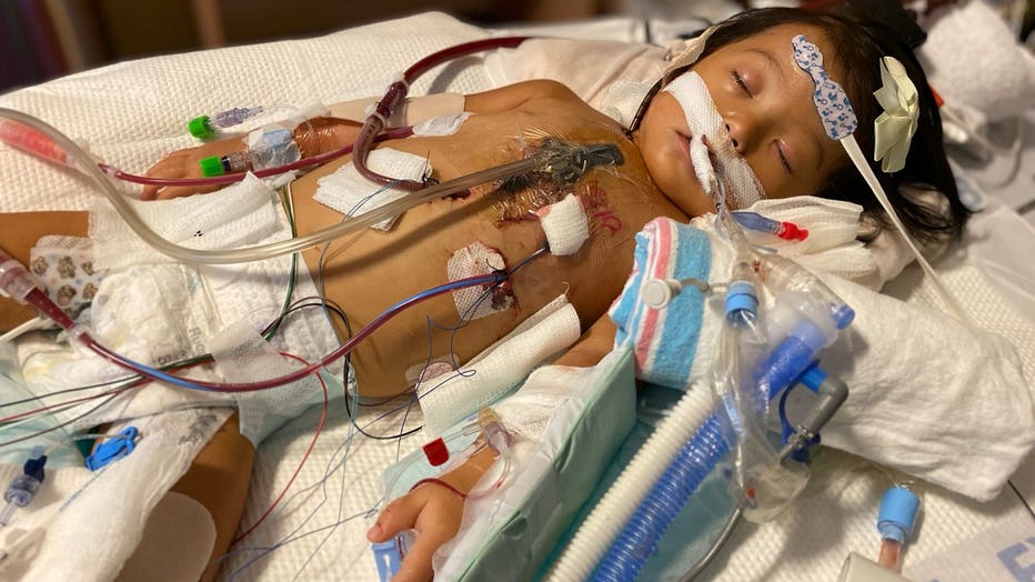 Very sick toddler in cardiac ICU