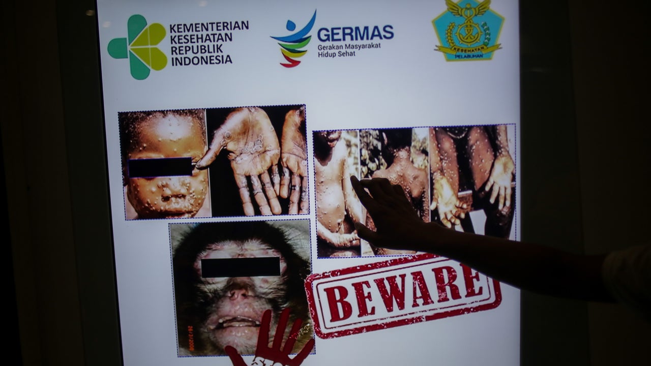 Monkeypox Pictures / Monkeypox Virus Wikipedia - In this centers for