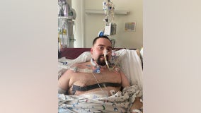 At 24, Florida man undergoes double lung transplant after COVID-19 destroys lungs