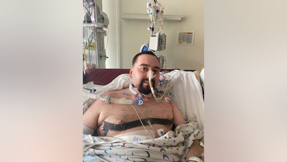 At 24, Florida man undergoes double lung transplant after COVID-19 destroys lungs