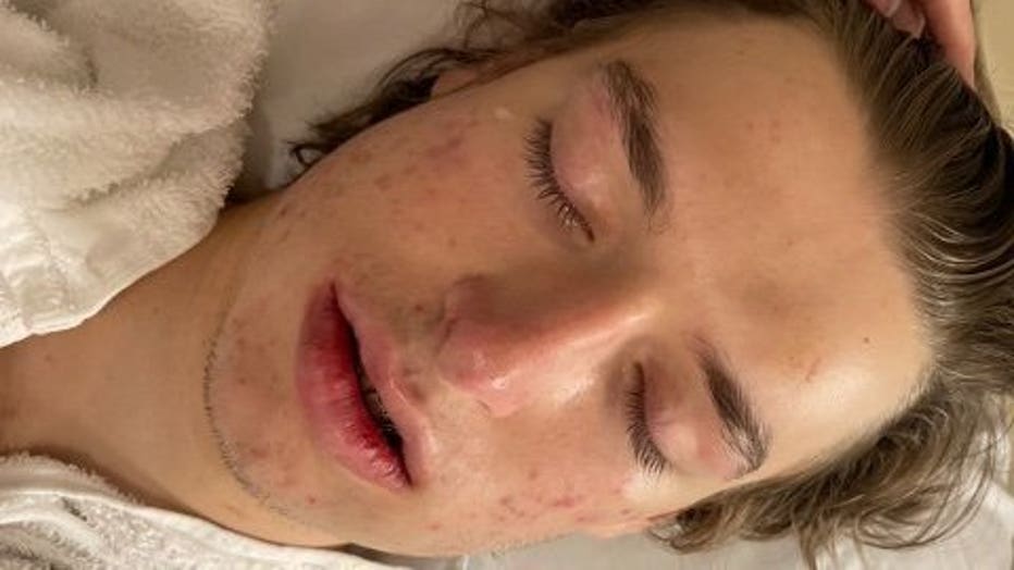 Allyssa Brooke-Cox says the attack on her son, Nick, left him with a broken jaw, a severe concussion, and whiplash. Even though it happened off school grounds, she wants school district leaders to hold everyone involved accountable.