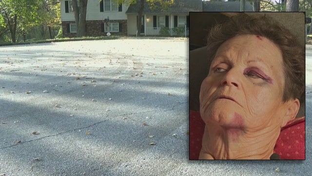 Lawrenceville woman struck by car while in her front yard, driver still at large