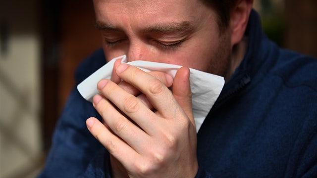Allergy sufferers have nearly 40% lower risk of COVID-19 infection, study says