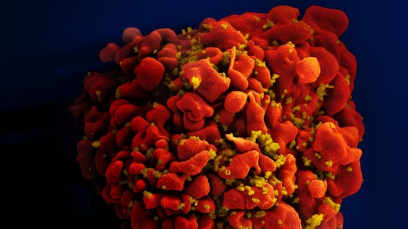 Fulton County to receive nearly $38M for battle against HIV