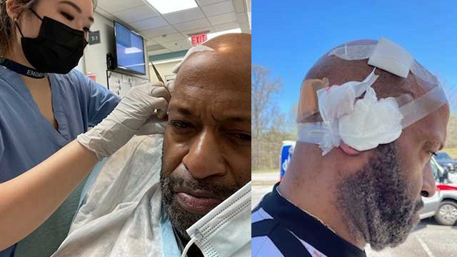 Basketball referee attacked by coach, 8th-grade team shares images of his injuries