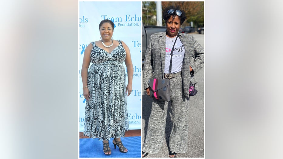 In side-by-side photos woman shows before and after images of her 35 pound weightloss.