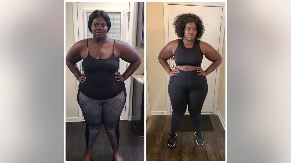 Woman standing before and after losing 100 pounds.