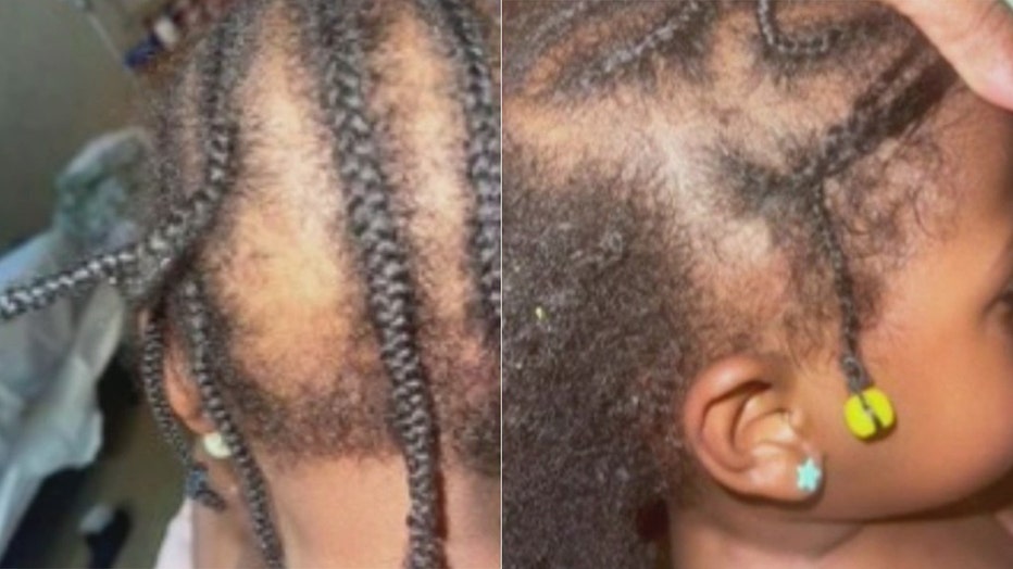 Kailyn Brown posted these images of her daughter's hair to social media saying the toddler's braids were pulled out at her Duluth daycare.