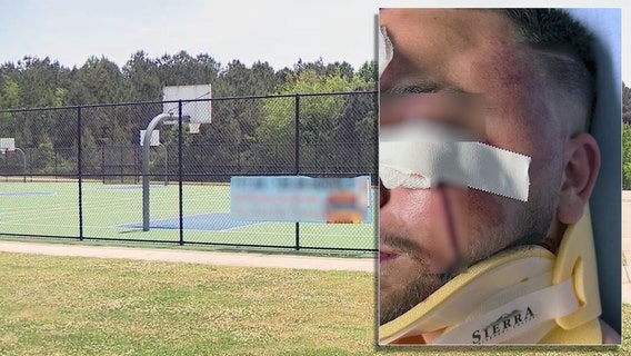 Man attacked during pickup basketball game at Dacula park