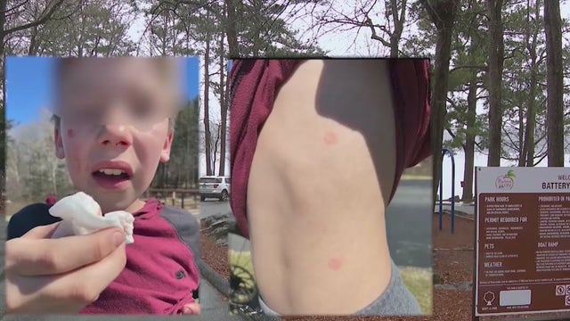 Cobb County police warn of reckless use of pellet guns after recent attacks