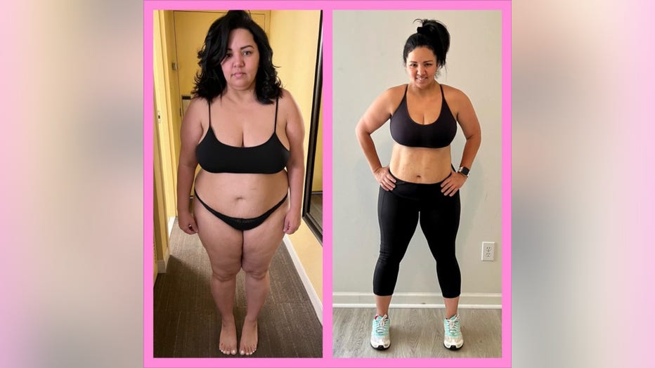 Woman stands in before and after weight loss